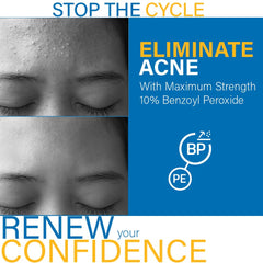 Close-up of DCL B Prox cleanser label showing 10% benzoyl peroxide.
