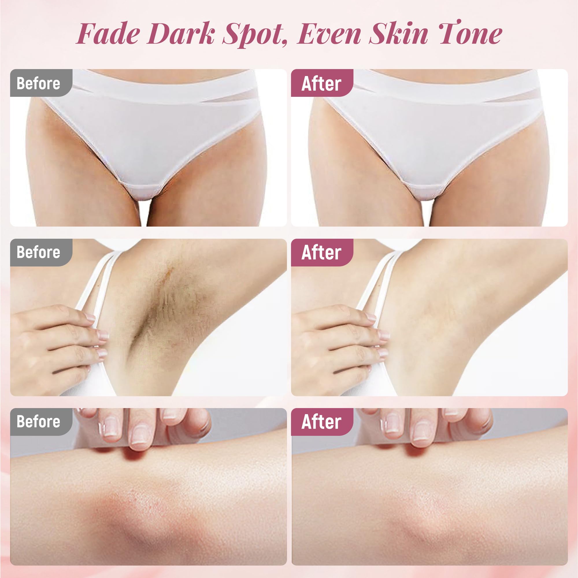 DCSCRK Skin Lightening Cream inner thighs close-up shows even tone