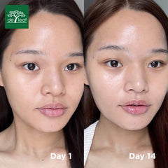 DE LEAF THANAKA container shown with creamy texture suggesting blemish-friendly hydration
