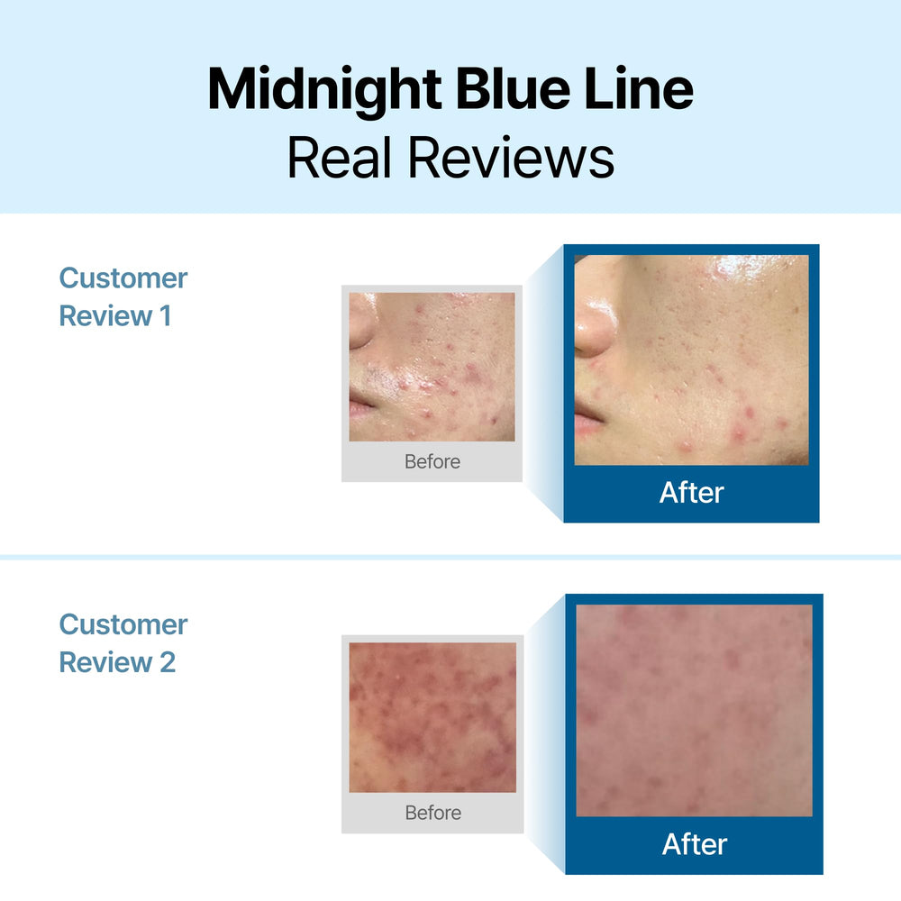 DearKlairs calming cream demonstrates cooling effect reducing redness after application
