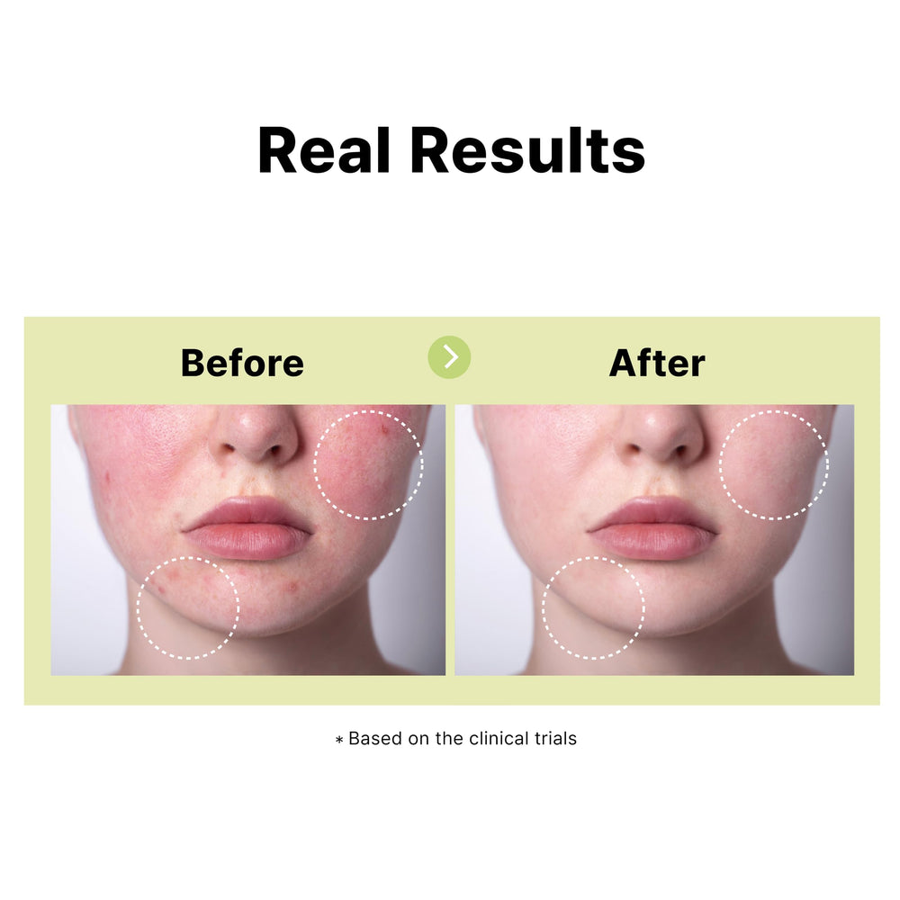 Application swipe shows gentle glide of DearMYDEW serum.