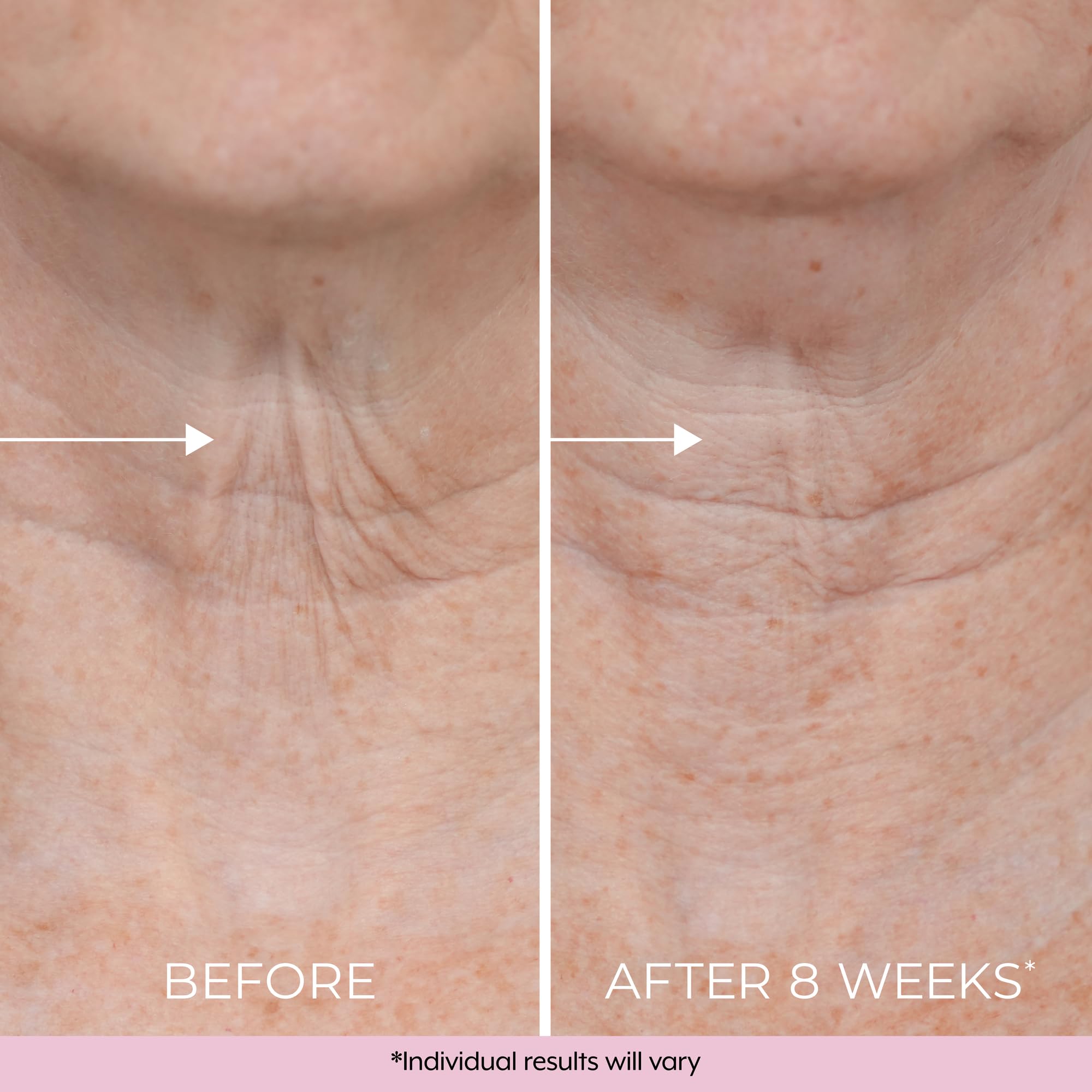 DEKLIDERM night cream bottle shown for evening skincare routine.