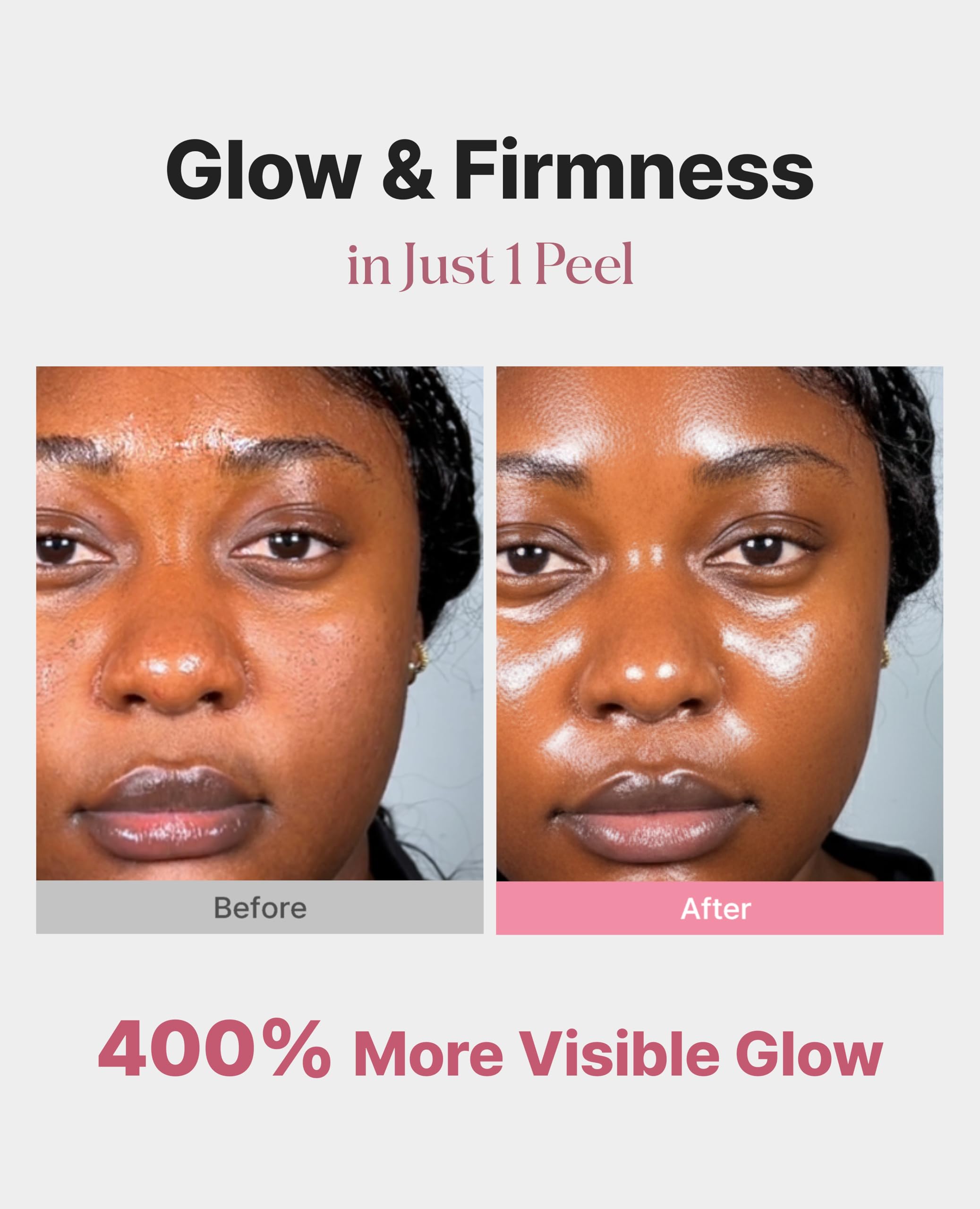 Delere Caviar Glow Mask application close-up shows smooth texture for gentle exfoliation.