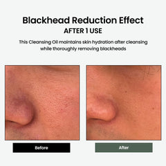 Centella TECA ingredient highlight showing soothing properties for sensitive skin during cleansing.