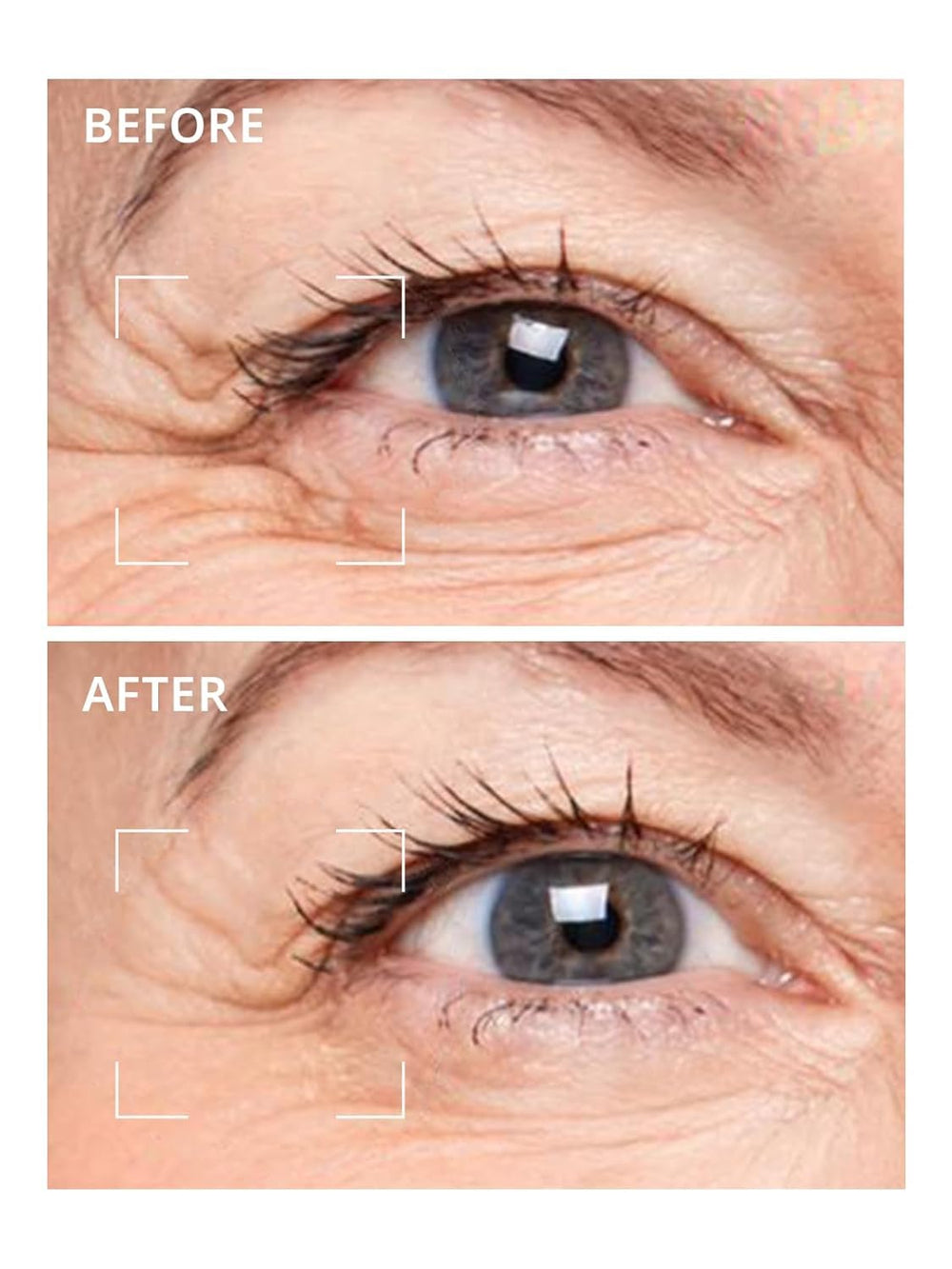 depology Deepcare+ hydrated skin around the eyes after use