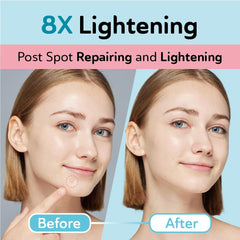 Derma Angel patch set covers post-acne spots for discreet wear
