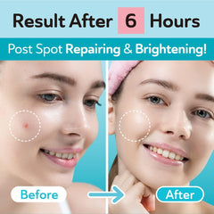 DERMA ANGEL Nighttime 12mm patch enables faster absorption
