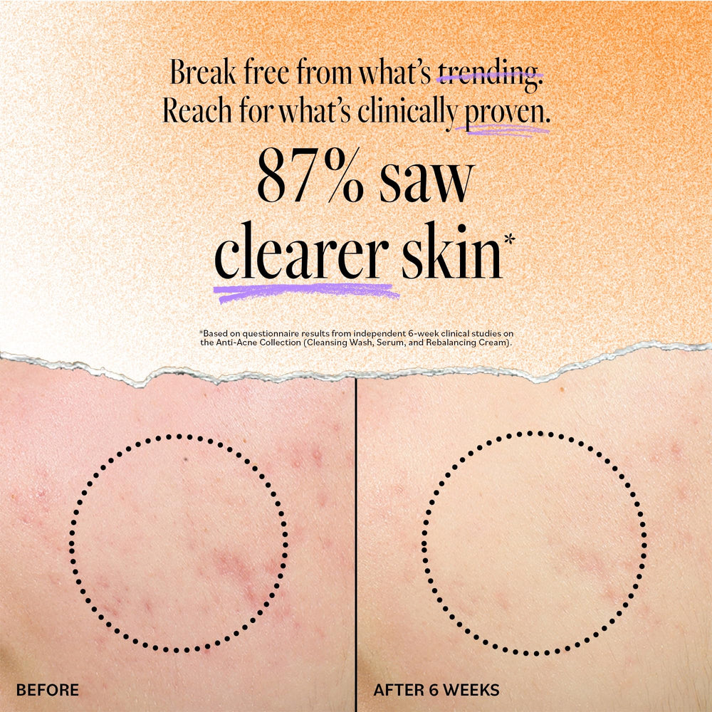 Derma E Acne Deep Pore Wash ingredients panel with tea tree and salicylic acid benefits.