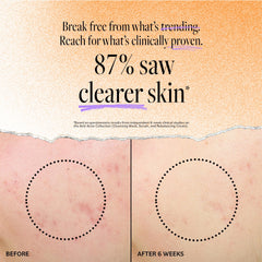 Derma E Acne Deep Pore Wash ingredients panel with tea tree and salicylic acid benefits.