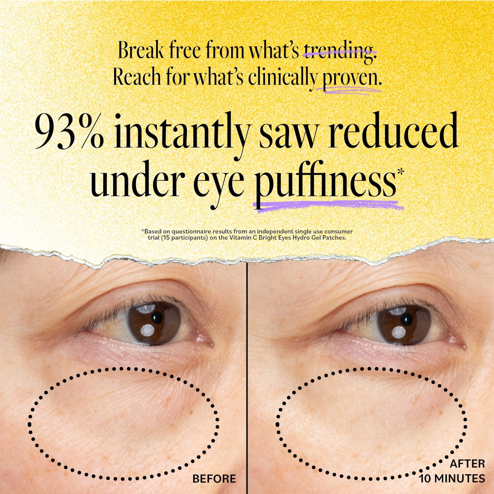 Derma E allantoin hydrating under-eye patches soothe and moisturize delicate skin