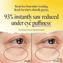 Derma E allantoin hydrating under-eye patches soothe and moisturize delicate skin