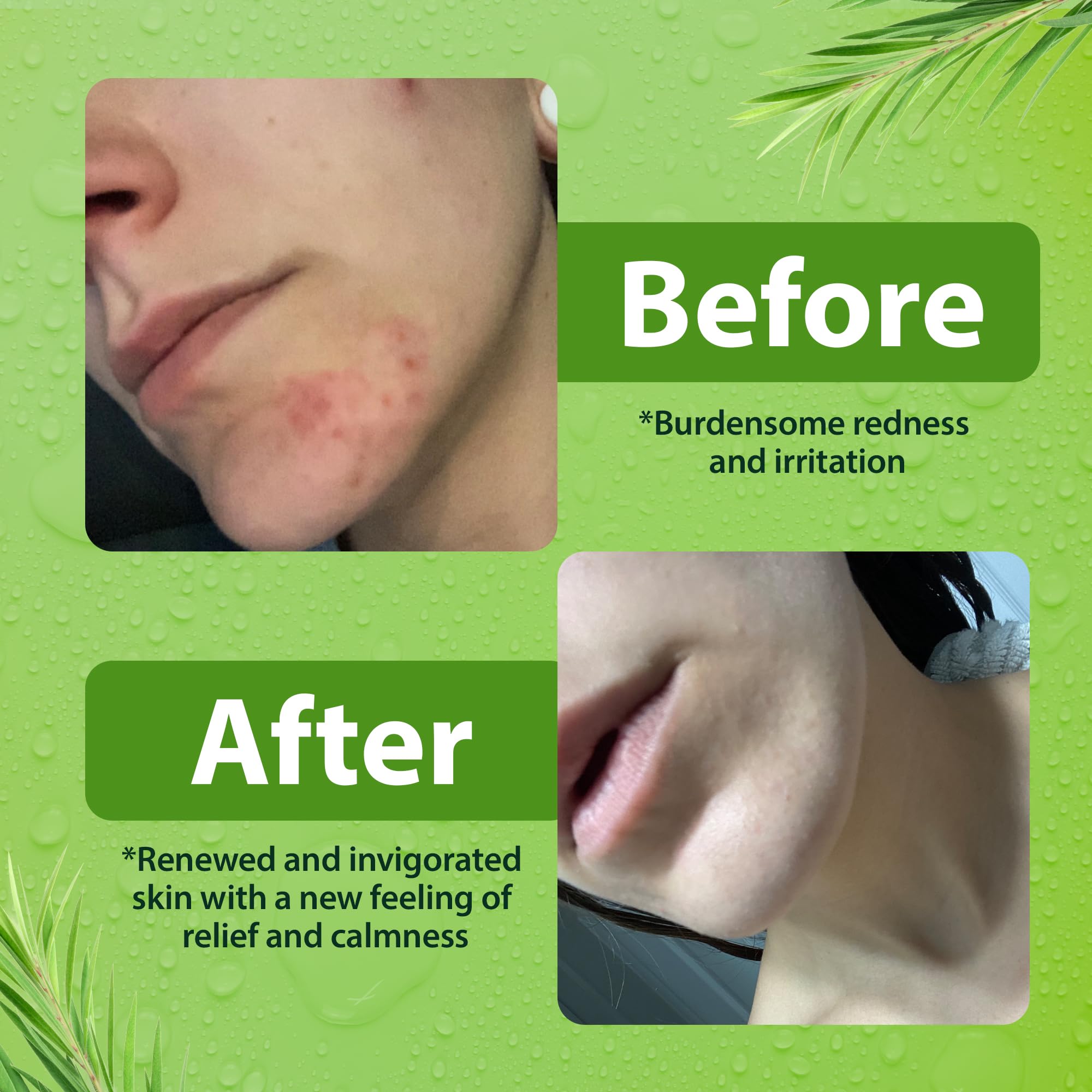 Derma-Nu 2-pack front view—paraben-free and gentle on all skin types