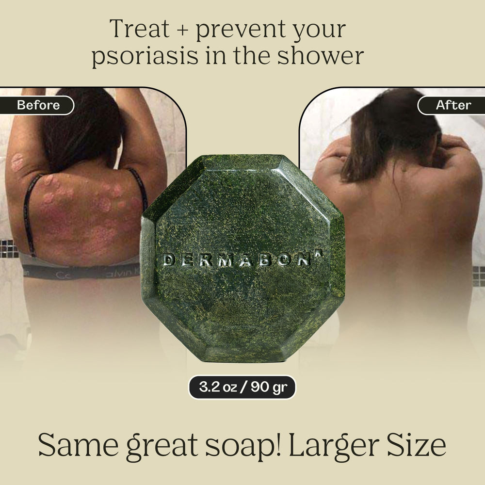 Skin-application image showing Dermabon soap bar with moisture retention.
