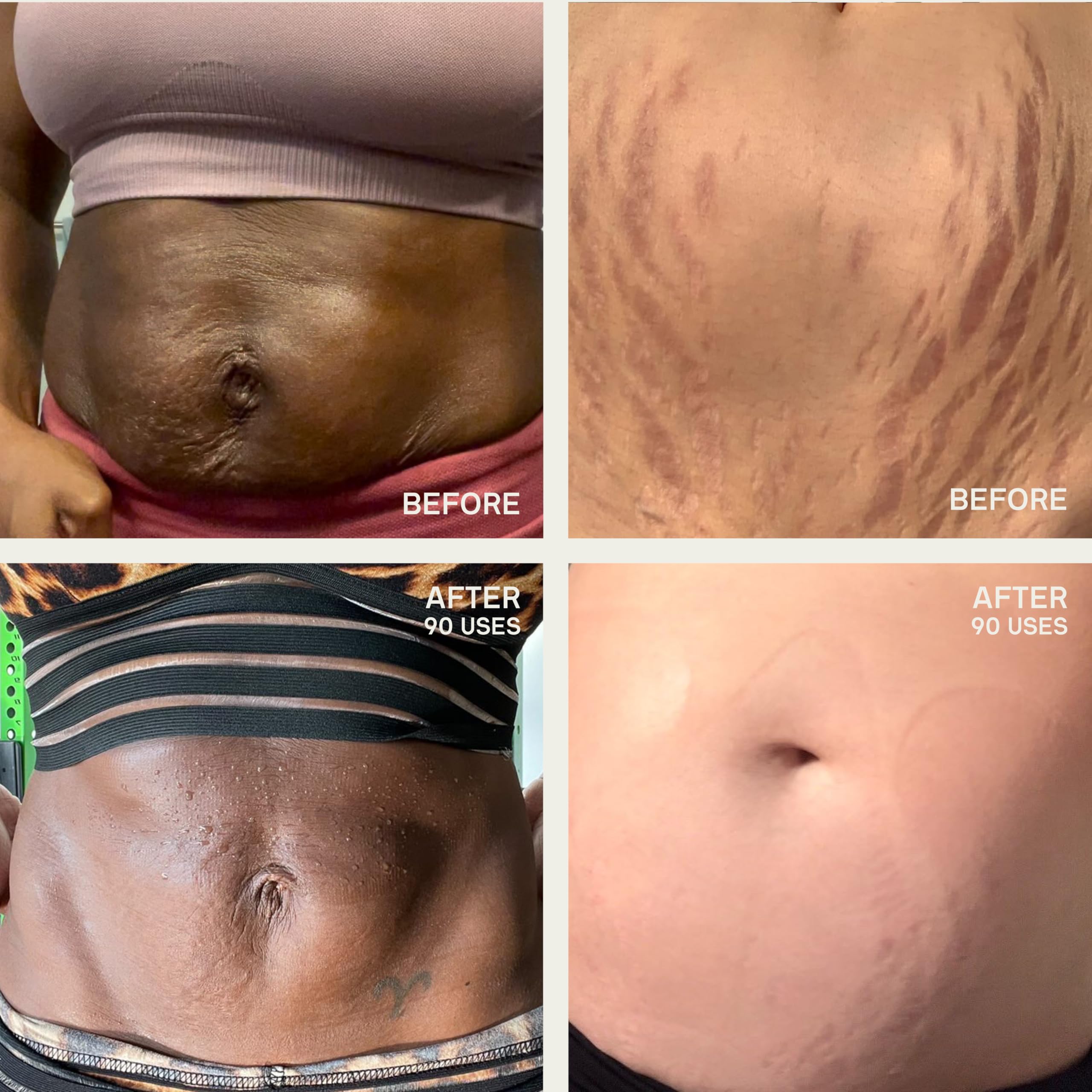 Dermaclara patch being applied to skin for easy wear 1–9 hours