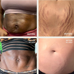 Dermaclara patch being applied to skin for easy wear 1–9 hours