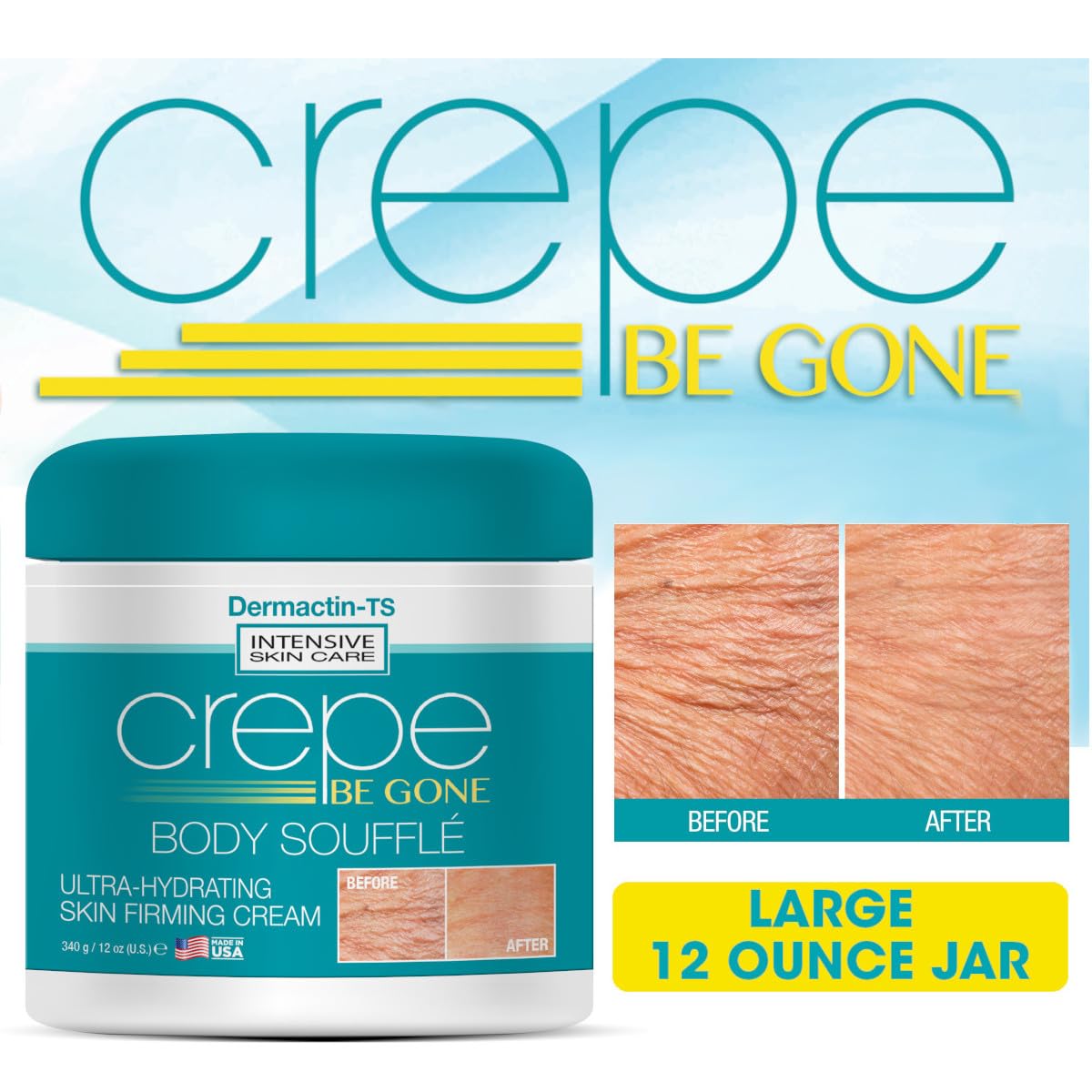 Dermactin Crepe Be Gone on legs to hydrate and soften skin.