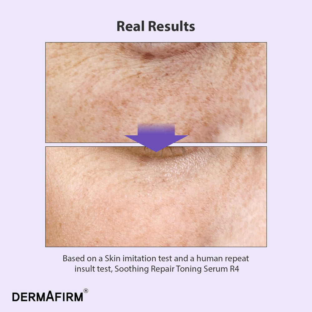 Dermafirm perilla-leaf extract visual highlights natural antioxidant skin support.