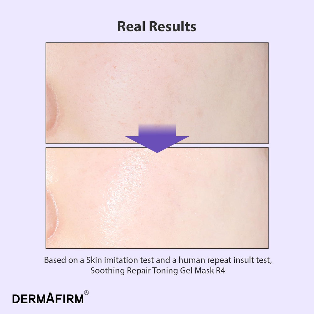 Dermafirm R4 hydrogel texture close-up shows cooling relief.