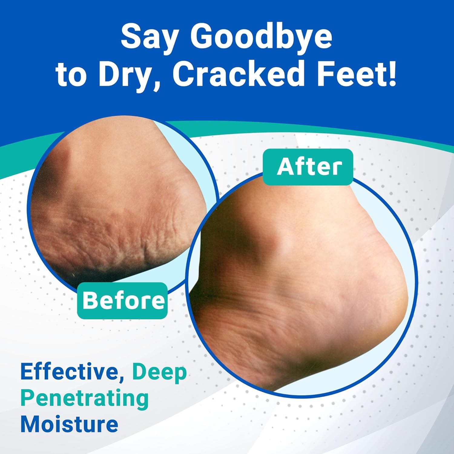 Fragrance-free Dermal Therapy Heel Care Cream suitable for sensitive skin.
