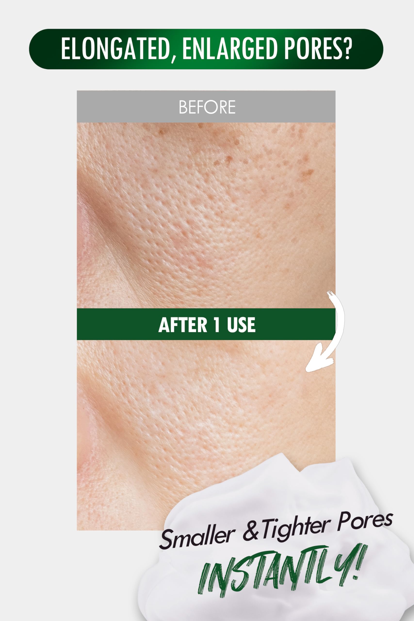 DERMALOGY Pore Zero Peeling Mousse with Beauactive Firming Complex for subtle lifting