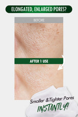 DERMALOGY Pore Zero Peeling Mousse with Beauactive Firming Complex for subtle lifting