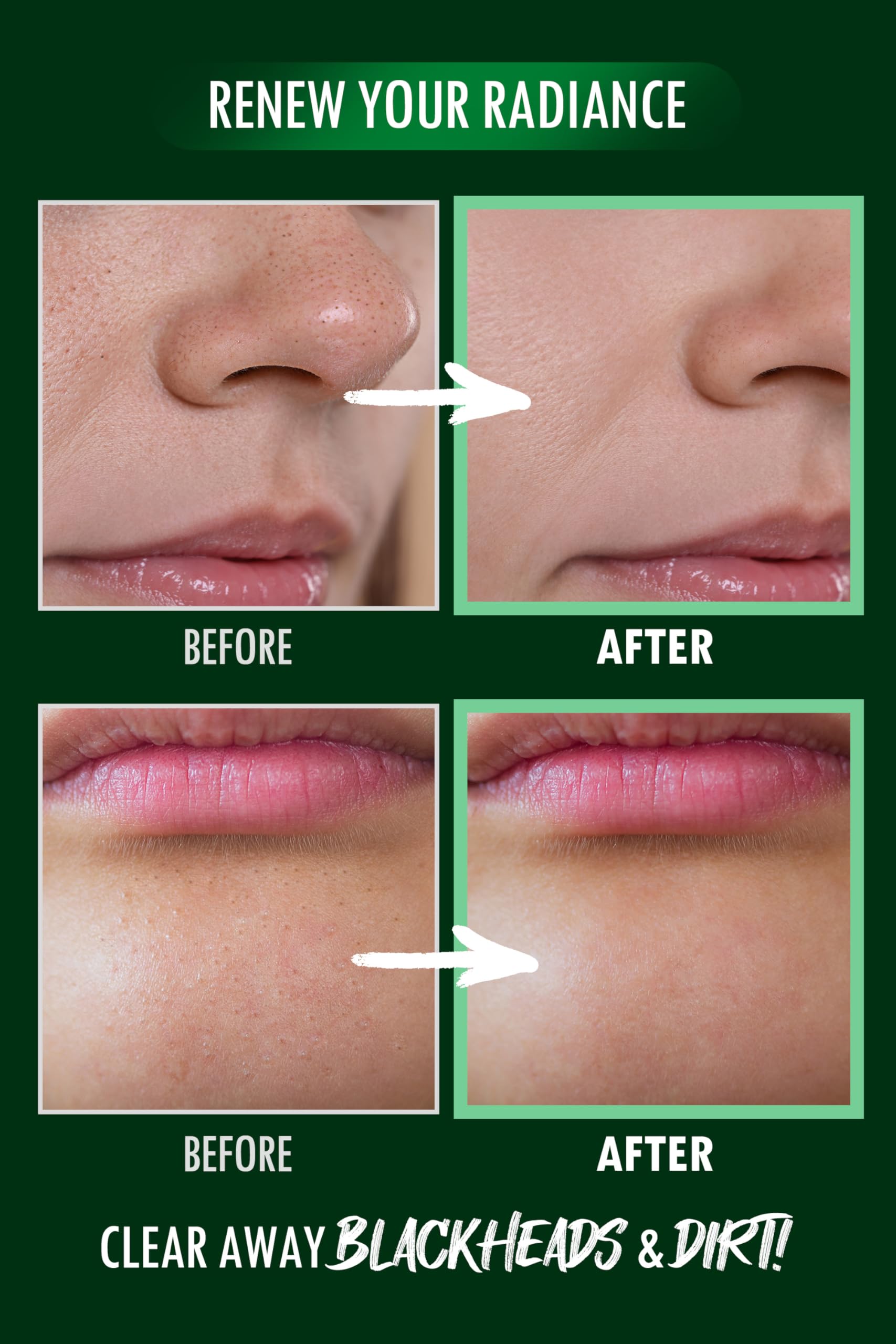 DERMALOGY by NEOGENLAB Pore Zero Peeling Mousse highlights drumstick seed extracts for gentle exfoliation