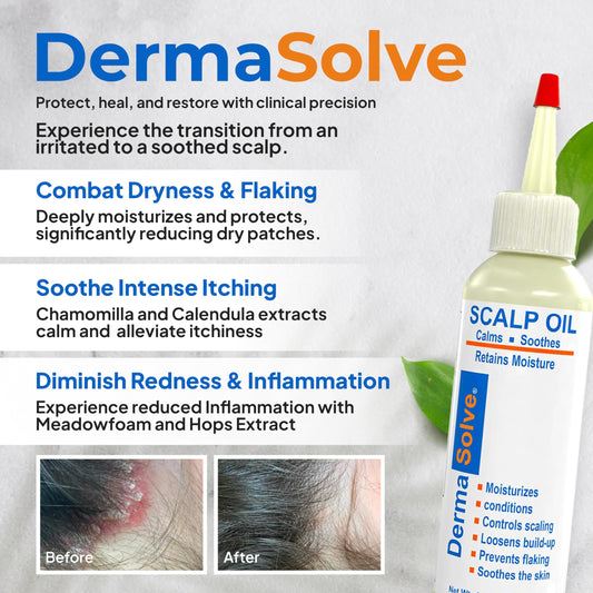 Dermasolve Psoriasis & Dandruff Oil application on scalp for soothing relief