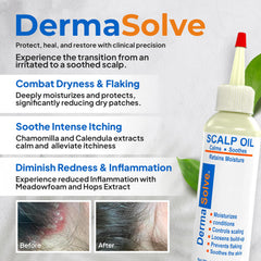 Dermasolve Psoriasis & Dandruff Oil application on scalp for soothing relief