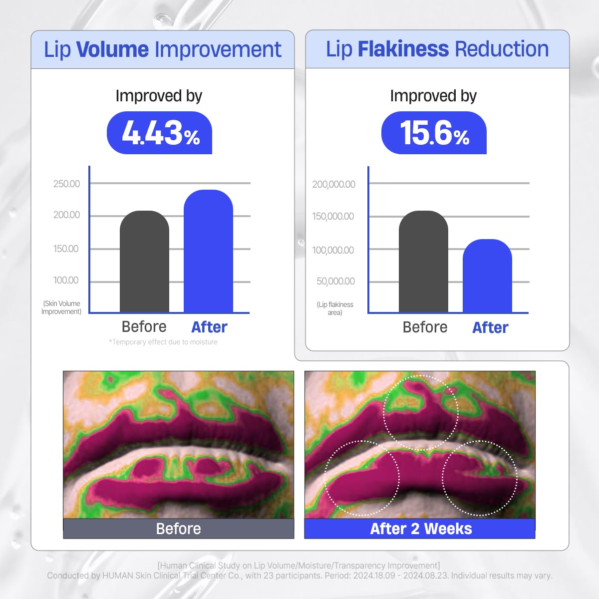 DERMATORY Hyalluron Peptide Volume Lip Mask Balm day and night use for flexible care.