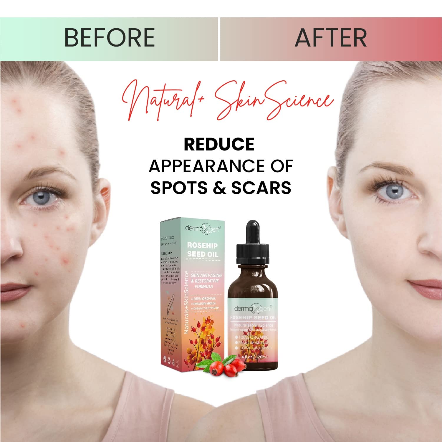 DERMAXGEN Rosehip Seed Oil on nails supports stronger cuticles.