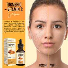 DERMAXGEN Turmeric Serum anti-aging focus in a clean setup.