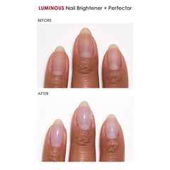 Dermelect before/after shows improved strength and smoother surfaces.