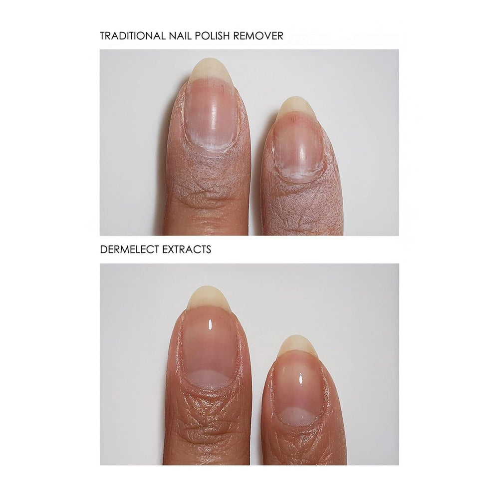 Dermelect Extracts wipe in action prepping nails before polish