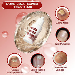 DERMFREE Toenail Renewal Serum being applied to a thick, stained nail.