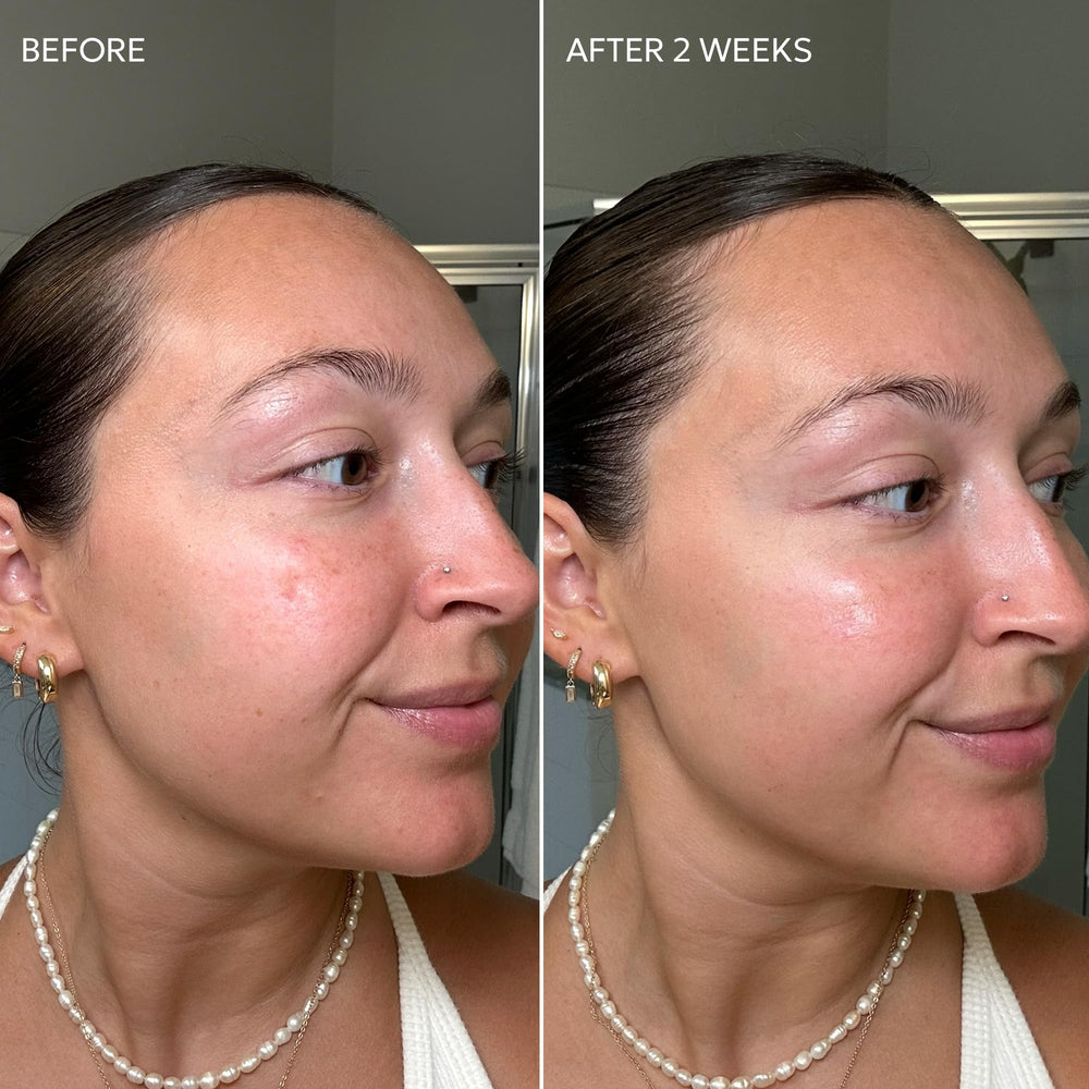 Dermisa vitamin C and licorice brighten the complexion