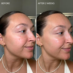 Dermisa vitamin C and licorice brighten the complexion