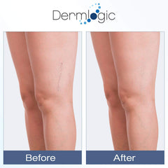 Dermlogic Vitamin K Cream texture close-up showing smooth, hydrating formula.