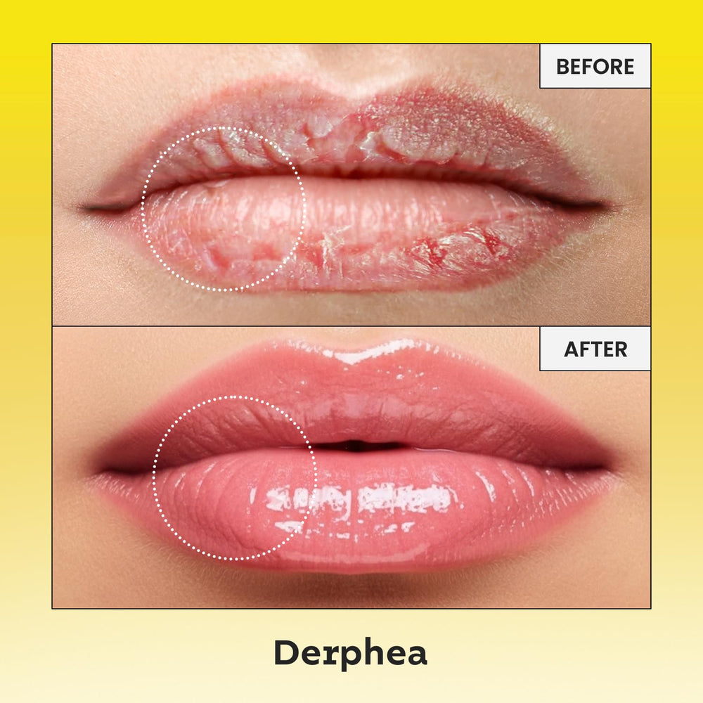 DERPHEA beef tallow formula with shea butter and vitamin E for dry lips