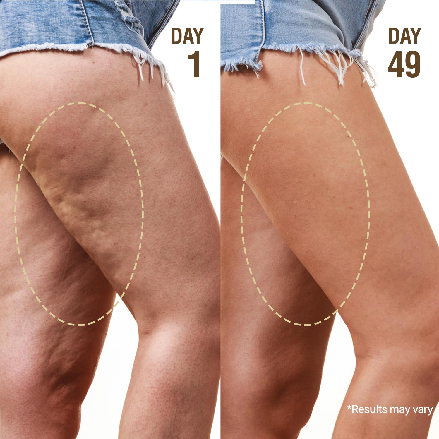 DERPHEA Crepey Repair Cream 2-pack display emphasizes value and support