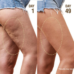 DERPHEA Crepey Repair Cream 2-pack display emphasizes value and support