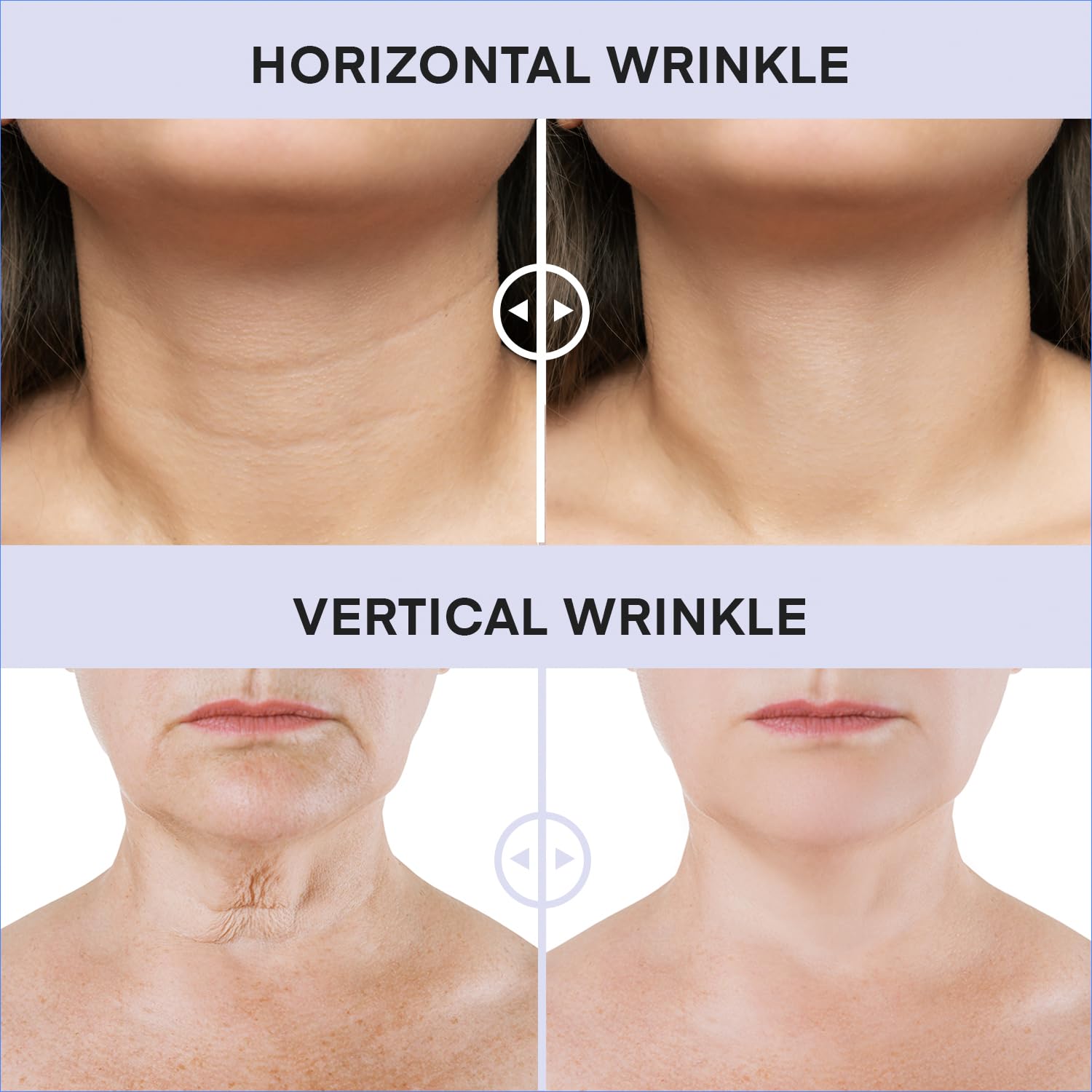 DERPHEA neck cream delivers a subtle lifting sensation on the neck.