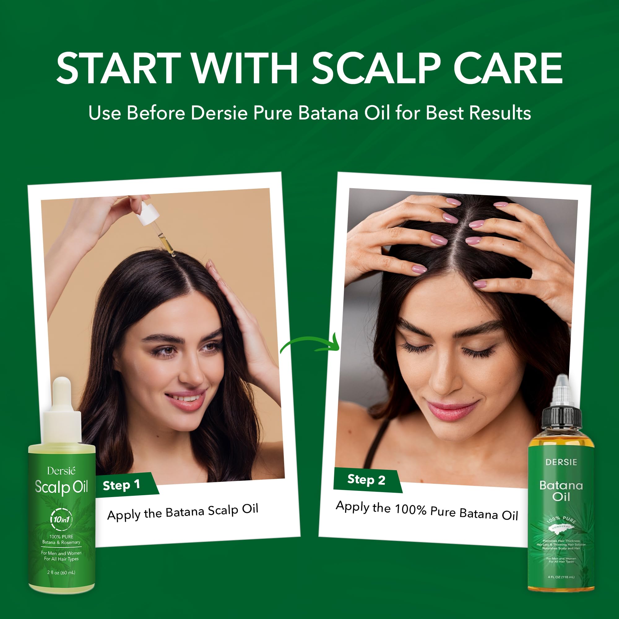 Dersie 60ml travel-size bottle enables on-the-go scalp care