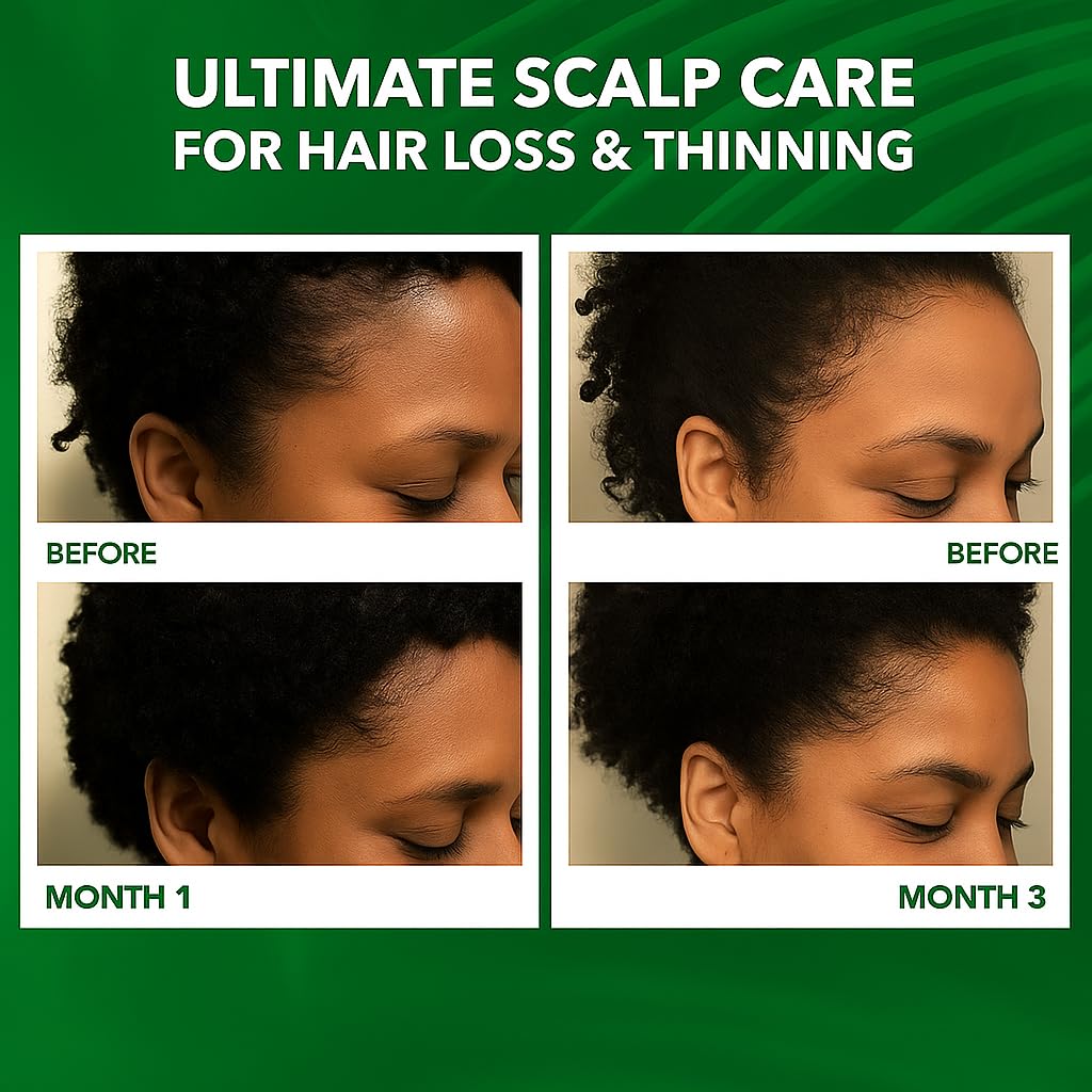 Dersie scalp massage application showing simple daily care for curls