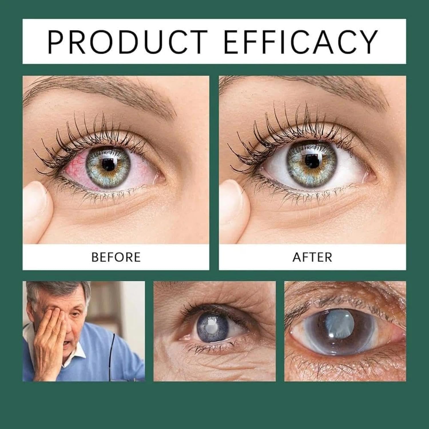 Optifusion Drops demonstrate tear-film mimicry for lasting hydration during screen work.
