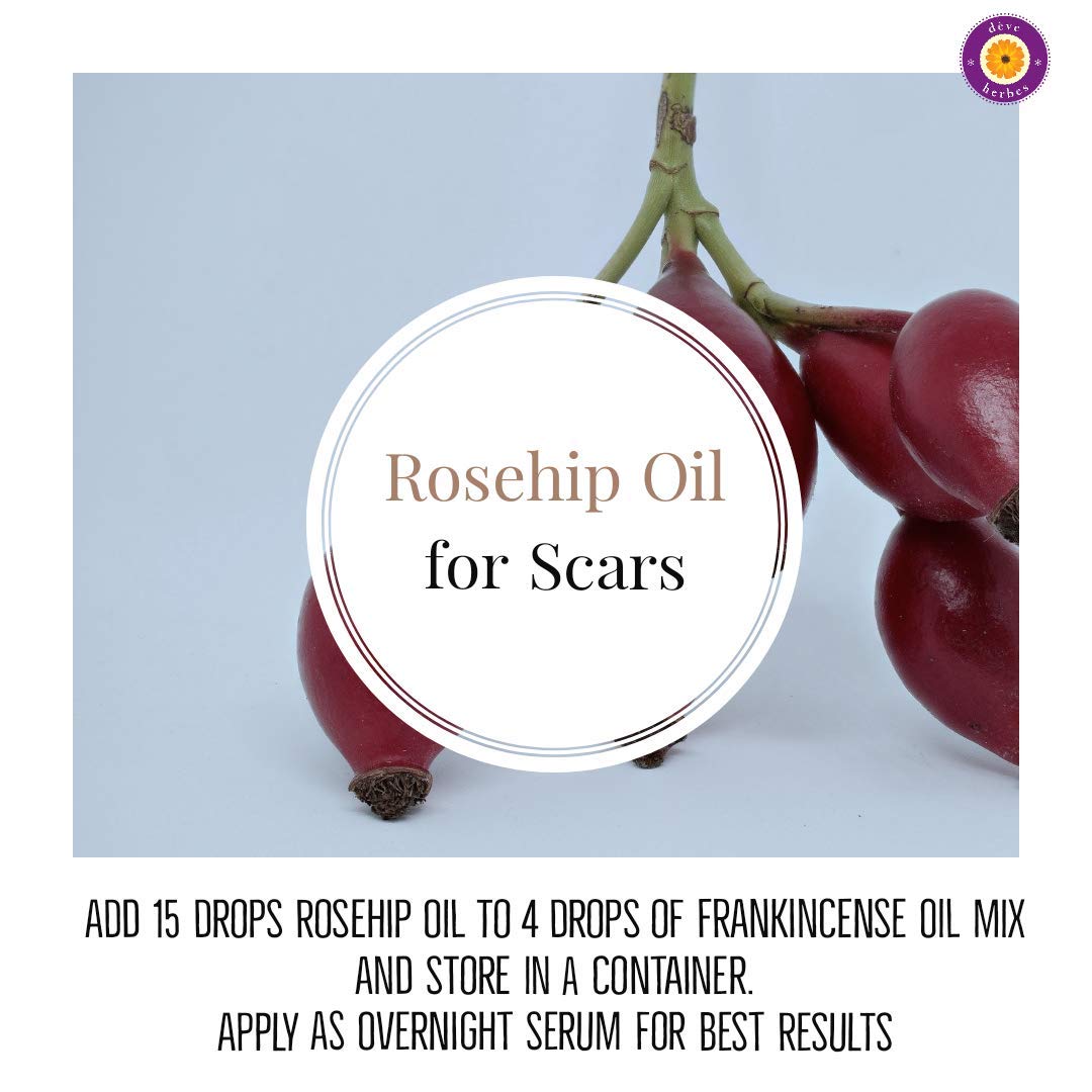 dve herbes Rosehip Oil skin application depicts lightweight, non-greasy nourishment