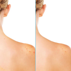Glycolic acid at 3% promotes gentle exfoliation