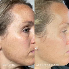 DIME Beauty TBT Serum ingredients close-up highlighting mandelic acid and bakuchiol for gentle care