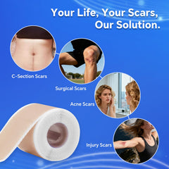 Discoliner silicone scar sheets reusable design supports ongoing scar care.
