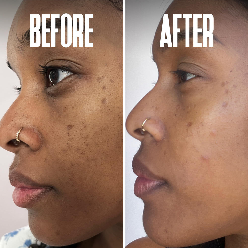 Packaging closeup of Divine Derriere dark spot serum