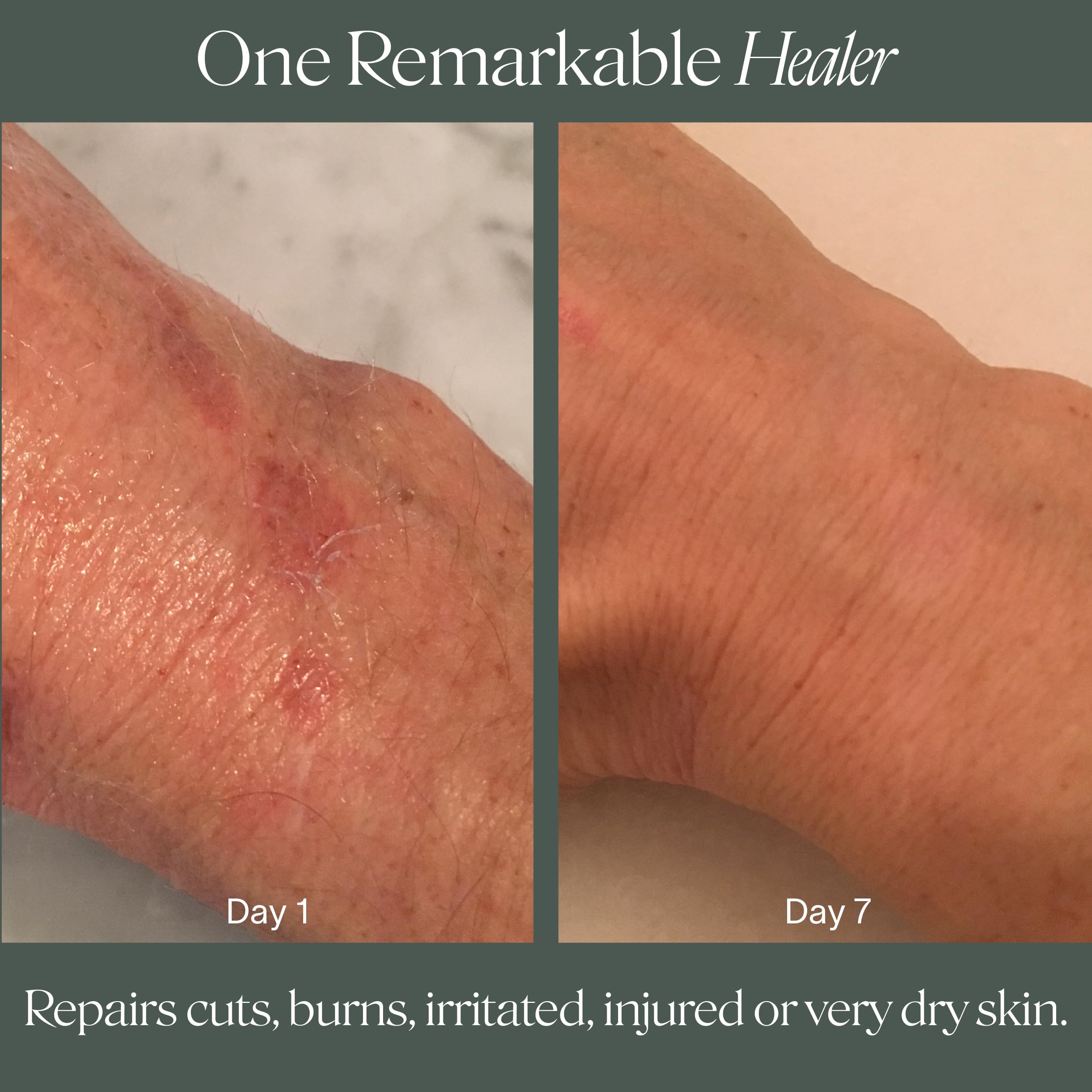 Hands-and-feet care with Doctor Rogers Restore Healing Balm delivers hydration.
